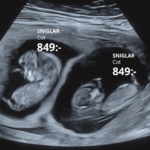 Destaques da semana. APOIANDO TODO TIPO DE MUDANÇA NA SUÉCIA